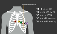 12 Kanal Ekg Anlegen 12 Kanal Ekg Durchf hrung EKYRO